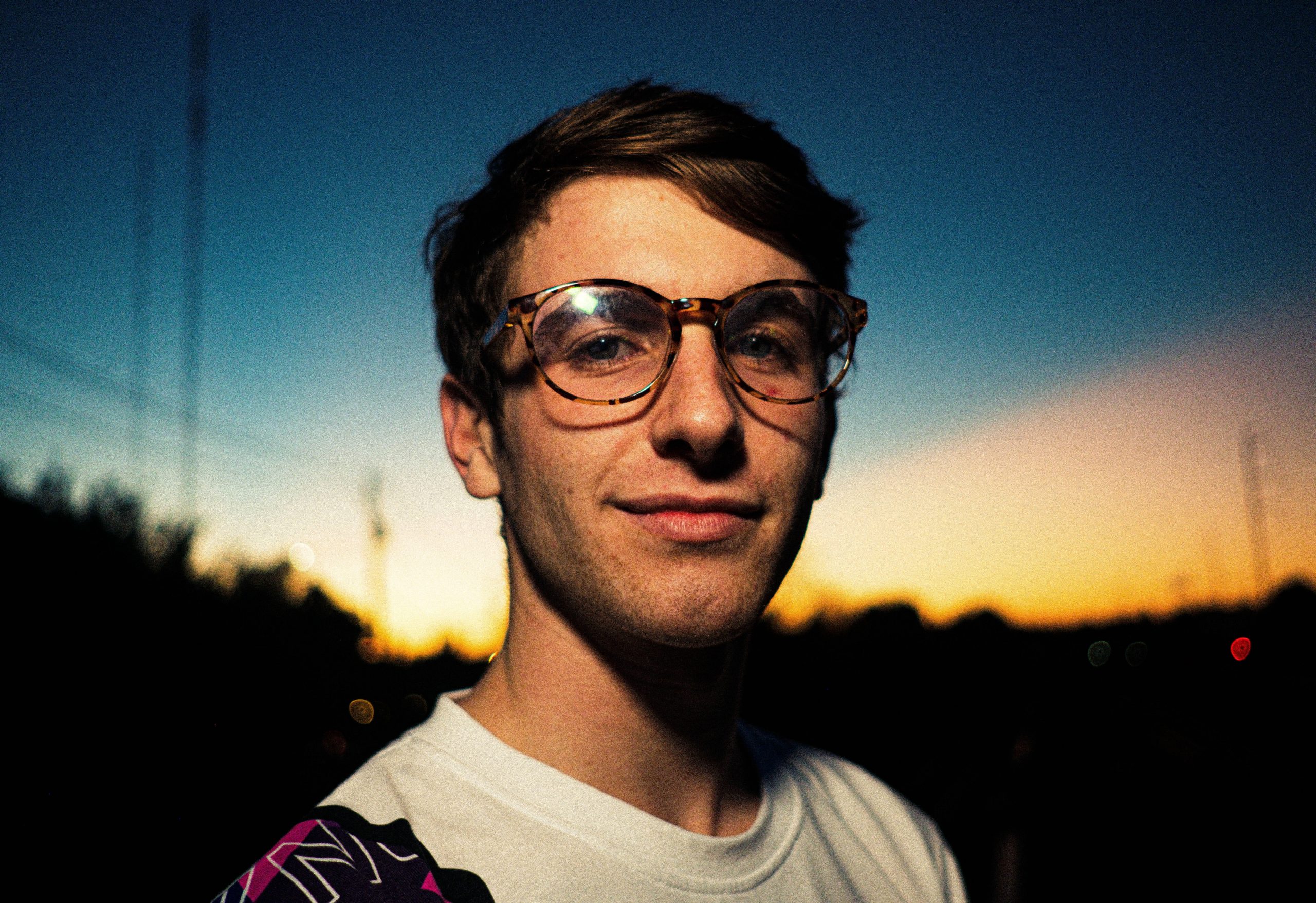 Photo of patient getting ready to get EVO ICL procedure