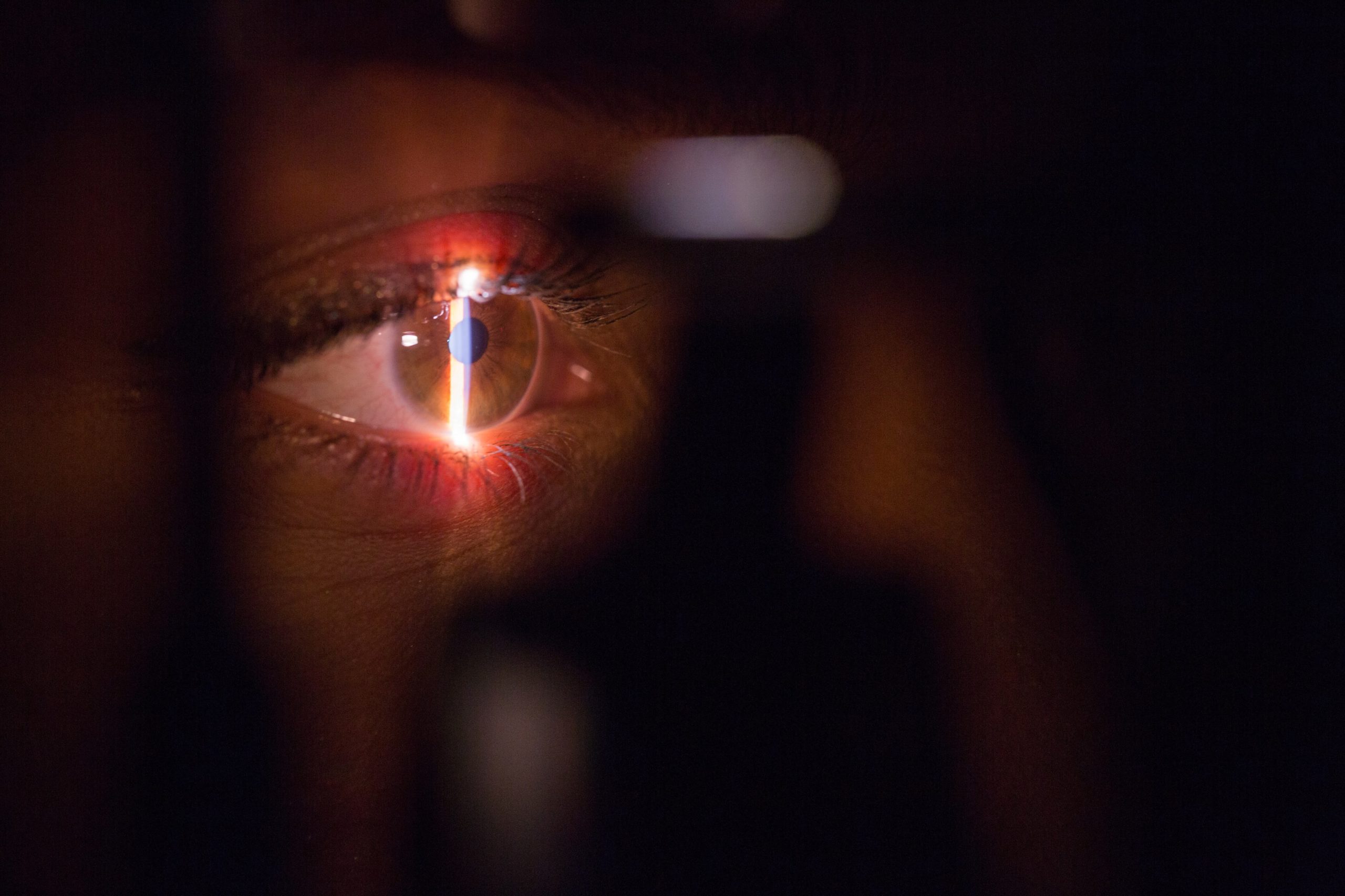 A close-up shows a doctor examining an eye with a slit lamp, revealing the detailed iris and pupil under bright light, similar to a pre-LASIK evaluation at ClearSight.