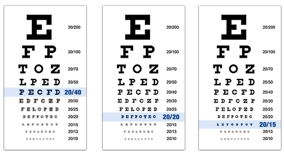 eye charts that demonstrate different levels of vision