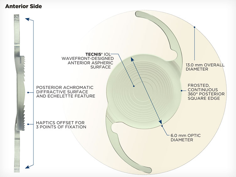 Clearsight LASIK and Lens offers an extended depth of focus lenses with wider range and quality of vision. These IOLs offer a good quality of vision and an increased depth of vision.