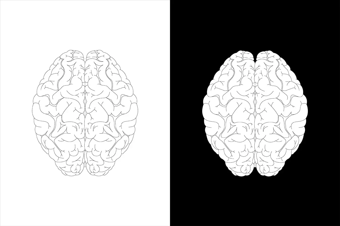 brain change with lasik